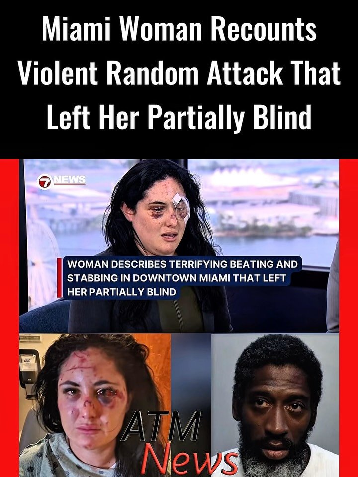 This is absolutely #horrible! Caitlin Dydzuhn of Miami, #Florida, said she is now partially blind after she was randomly attacked outside the MarinaBlue condominiums building on the morning of March 19, 2026. —She said she was fighting alone with no one to help as 49-year-old Raydean Johnson, a #homeless man, brutally beat her and slashed at her multiple times with a homemade shank made from a tire pressure gauge and a nail. Thankfully, a good Samaritan intervened. Police took Johnson into custody after a three-hour-long standoff, and he has now been charged with attempted #murder.