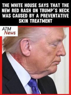 The #WhiteHouse reportedly told @forbes via email that the red rash that was visible on #PresidentTrump’s neck during the Medal of Honor ceremony on Monday was caused by a preventative skin treatment.—White House doctor #SeanBarbabella reportedly prescribed Trump a cream for that side of his neck, and they expect the redness to last a few weeks.