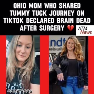 This is #heartbreaking. #RachelTussey, 47, who was actively sharing her #MommyMakeOver, Tummy Tuck journey on #TikTok, has been declared "brain dead" and will likely slowly pass away, according to her husband, Jeremy Tussey, and a GoFundMe set up to cover her extended hospital stay.—Rachel posted on TikTok on February 25, 2026, moments before her surgery, asking her followers for #prayers. —On March 3, her husband posted an unfortunate update. He said that he received a call from Rachel’s surgeon after the surgery, letting him know that everything went well, and he could see her in the recovery room. When he went, he said Rachel was in her room with one nurse. She was a little responsive at first, but all of a sudden, her face and lips changed color. The nurse allegedly told them she had given her pain medicine, something Rachel previously said she didn't like.—Jeremy said Rachel quickly became unconscious, and her surgeon instructed them to call 911. They were transferred to another hospital, where she was placed on life support and declared brain dead.—On March 5, she was taken off life support and is currently in hospice care, according to her GoFundMe page.