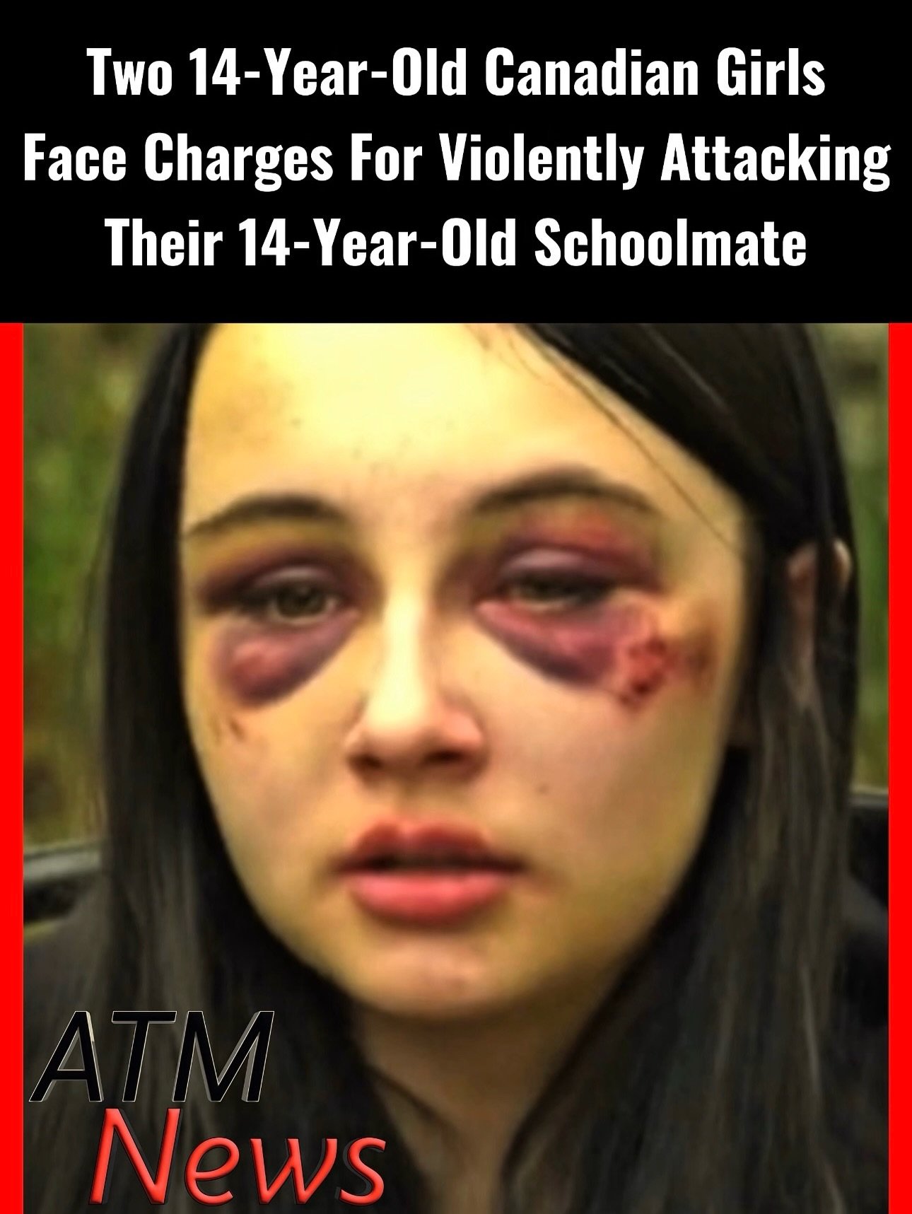 Two #Canadian girls, both 14, are now facing #assault charges after a viral video allegedly shows them violently attacking their schoolmate, 14-year-old Rylin Brinston, in an off-campus grassy field in Red Deer, Alberta, around 2:21 p.m. on Monday, May 11, 2026.—Many community members attended their first court appearance, calling for justice and showing support for the victim. Many #parents want the school, Hunting Hills High School, to take severe action against both of them.