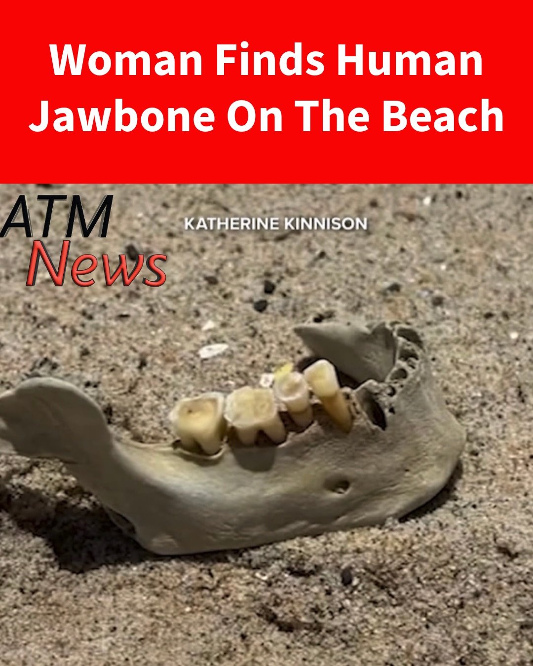 A #NewYork woman visiting #SanClemente, California, was walking along Linda Lane Beach last week when she found what turned out to be a human #jawbone. It was determined to be of Native American ancestry and was turned over to the Native American Heritage Commission.