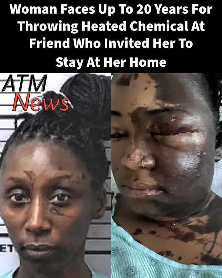 On Wednesday, August 19, 2026, an Alabama jury found Quincheay “Q” Williams guilty of first-degree assault for throwing a heated chemical substance at her friend, Jasmine Clausell, back in February 2025.—On February 11, 2025, Jasmine Clausell invited Quincheay Williams, a friend of 5 years at the time, to live with her temporarily in Mobile, Alabama, after hearing that Quincheay and her dog had been living in a car in Atlanta.—Not long after Quincheay moved in, Jasmine said she noticed a behavioral change and that Quincheay had been ungrateful, always complaining. Things escalated when Jasmine asked her to leave.—On the morning of February 25, 2025, while Jasmine was preparing for school, she heard Quincheay put something in the microwave. Quincheay then approached her and threw that substance at her, burning her face and other parts of her body, blinding her in one eye. Quincheay also pulled out a gun, but before she could use it, Jasmine’s grandfather intervened, wrestled with her, and disarmed her.—Quincheay Williams now faces up to 20 years in prison. Her sentencing hearing is scheduled for October 14, 2026.—#Alabama #Friends #Assault #Chemical #Justice