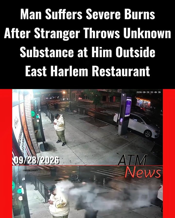 A 44-year-old man suffered severe burns after a stranger threw an unknown substance at him while he waited for a food order outside Cravin Crispy in East Harlem. The attack happened Monday, September 28, 2026, around 8:47 p.m., near Park Avenue and East 116th Street, according to police. —The victim, Mr. Alcantara, suffered burns to the left side of his face, his ear and the back of his neck, leaving blisters and patches of discolored skin. He told ABC7 that he will need a skin graft and that doctors said he was fortunate the substance missed his eye. After the attack, he ran into the restaurant screaming for help. —He was taken to Harlem Hospital in stable condition. Police are seeking the attacker, and the substance has not been identified.